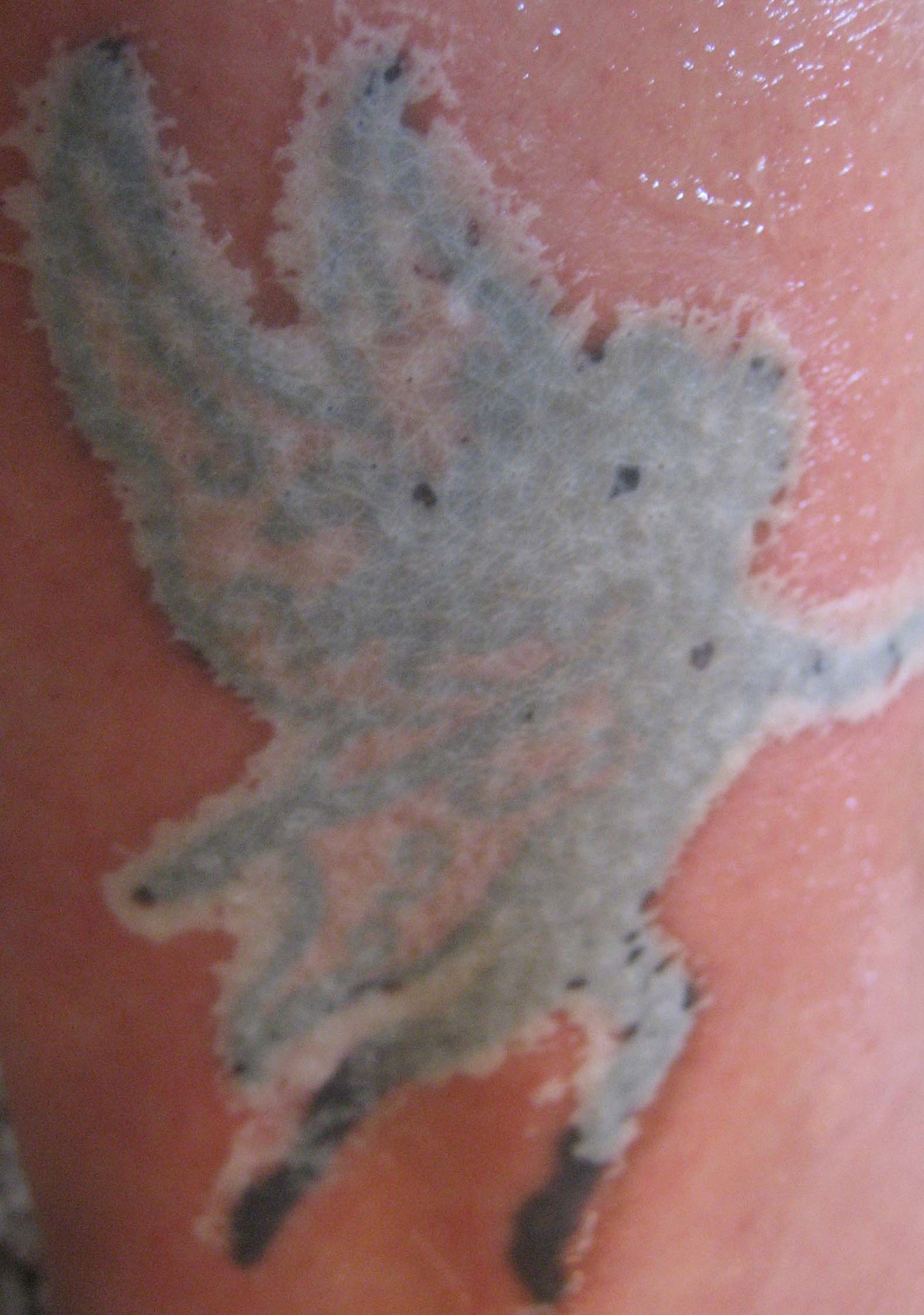 Nuviderm At Home Tattoo Removal: Second Application June 29, 2008