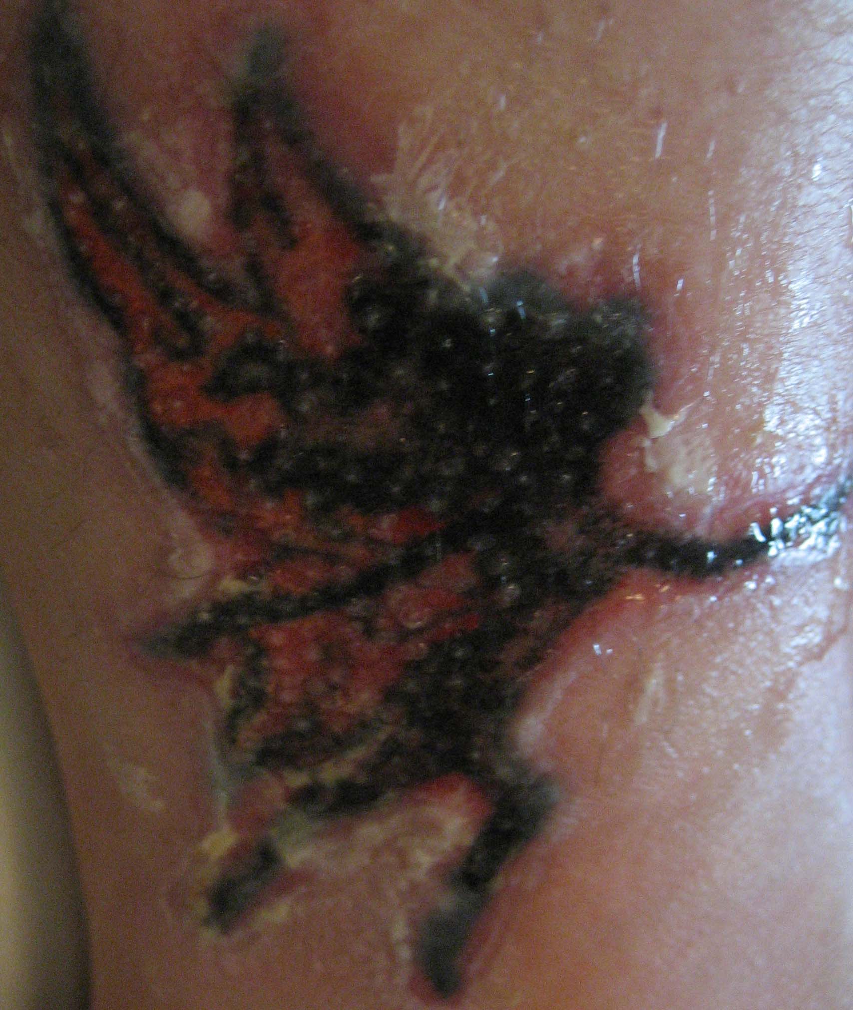 What Do Peeling Tattoos Look Like