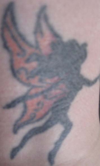 Nuviderm At Home Tattoo Removal: Updated Before and After November 4, 2008