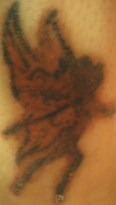 tattoobeforemederma1